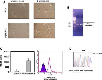 hTERT Transduction Extends the Lifespan of Primary Pediatric Low-Grade Glioma Cells While Preserving the Biological Response to NGF